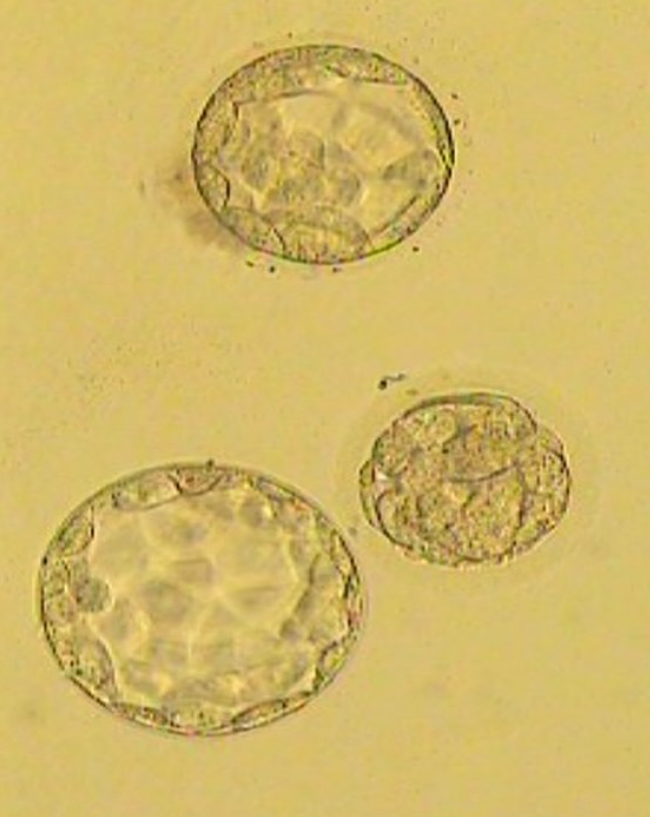 IVF blastocita